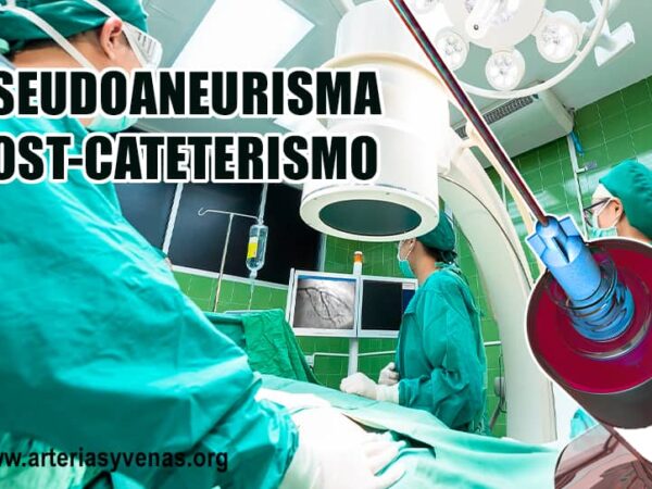 Pseudoaneurisma femoral post cateterismo